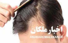 کمبود کدام ویتامین‌ها سبب ریزش مو می‌شود؟